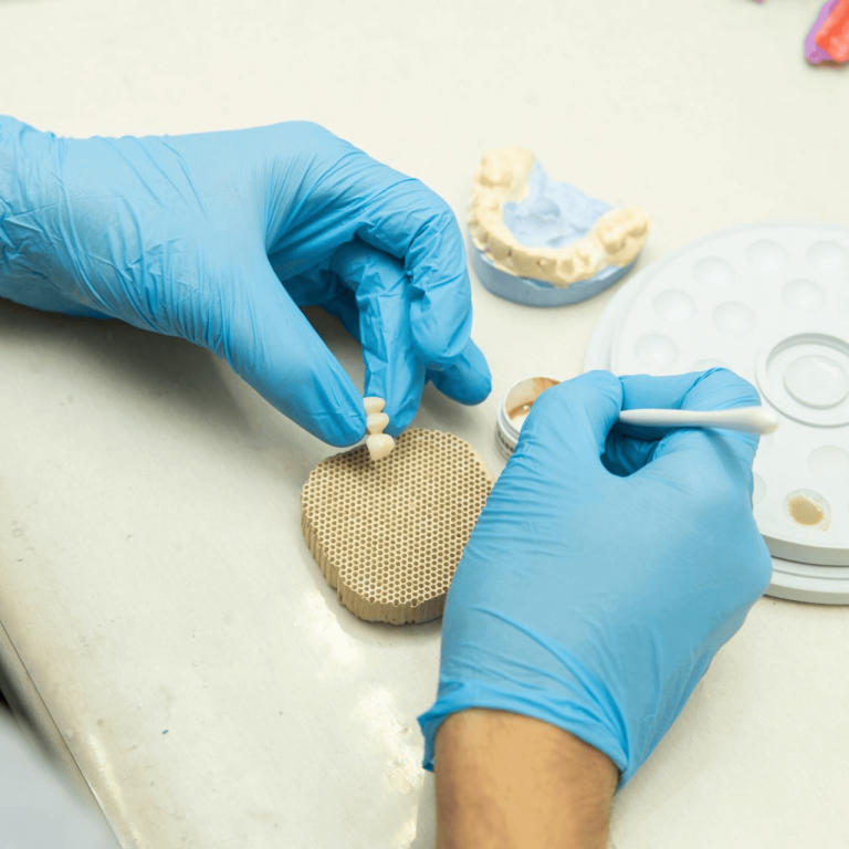 Dentista lavora su protesi dentaria